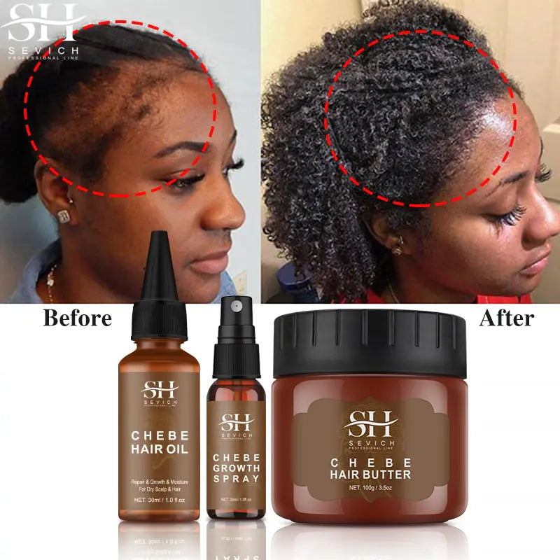 Spray de crescimento de cabelo louco africano